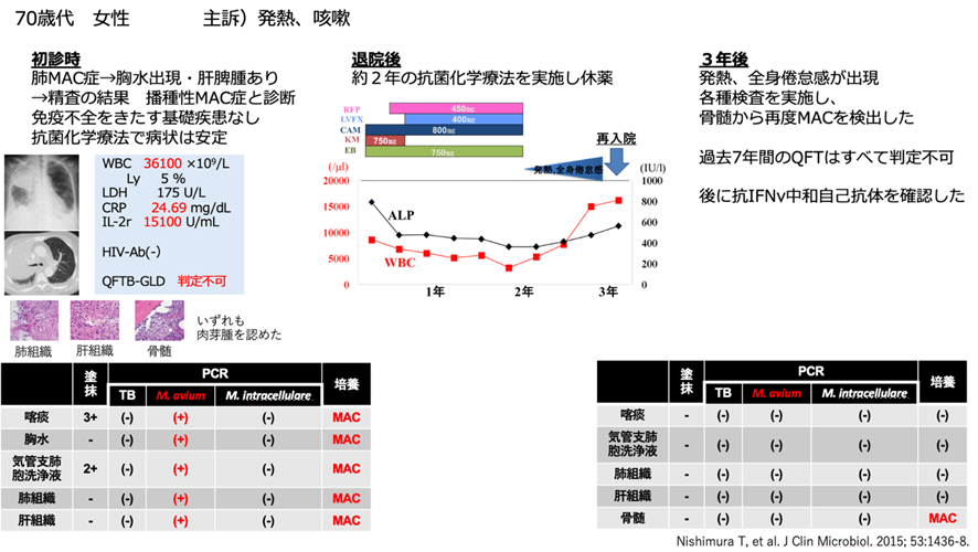図:抗菌化学療法終了後に再発し、骨髄培養からMACを検出した症例