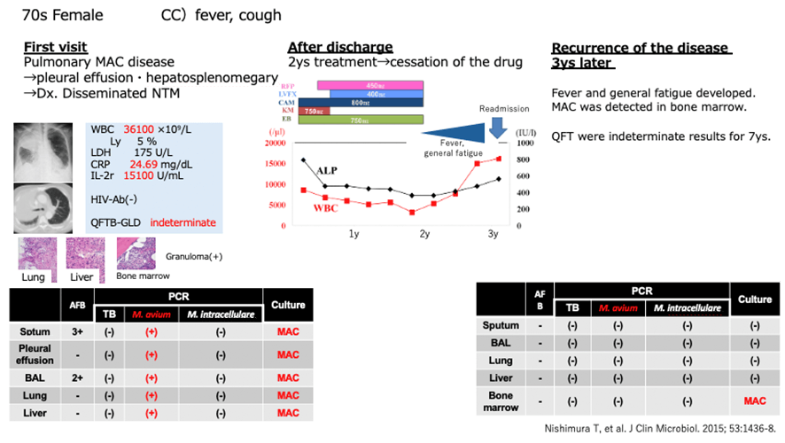 figure:A Female Patient in her 70s Reported Recurrence After Completion of Antibacterial Chemotherapy with MAC Detected in Bone Marrow Cultures